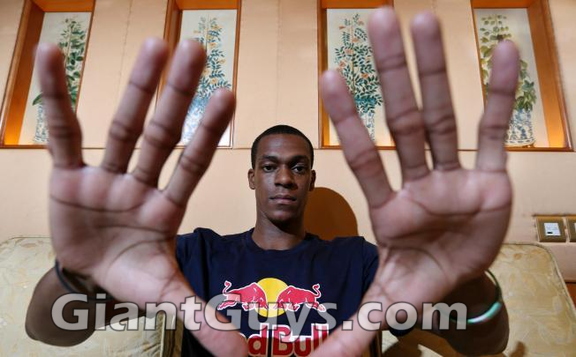 rondo-huge-hands